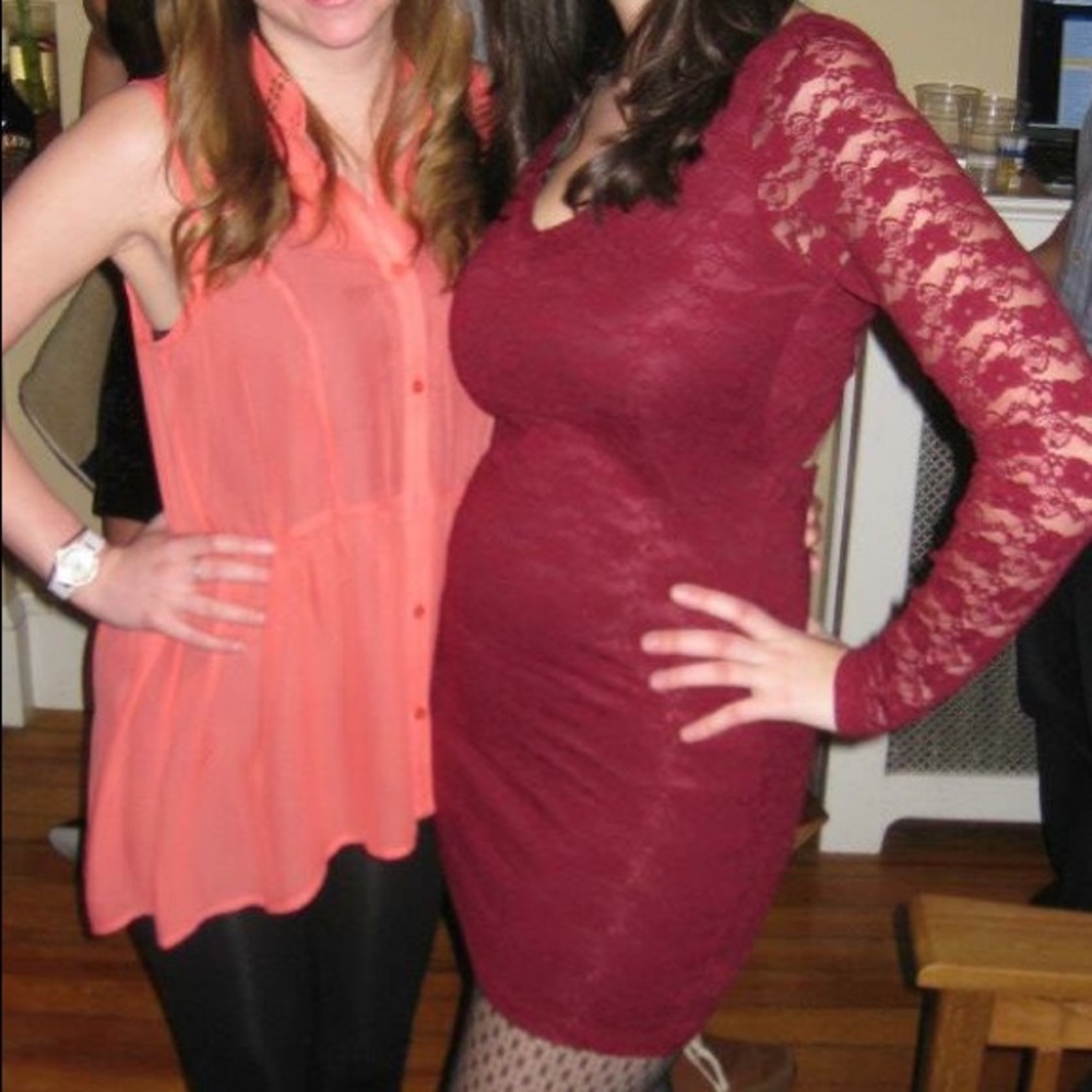 Forever 21 Lace Dress